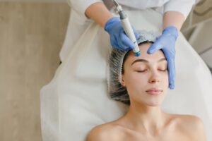 Tratamiento Dermapen en Ermoni